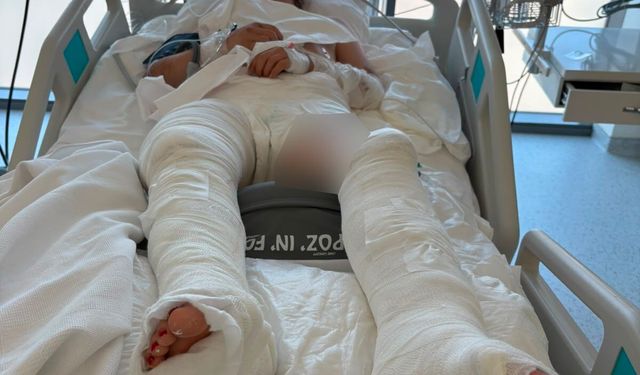 Çarptığı genç kızın üzerinden geçip kaçtı