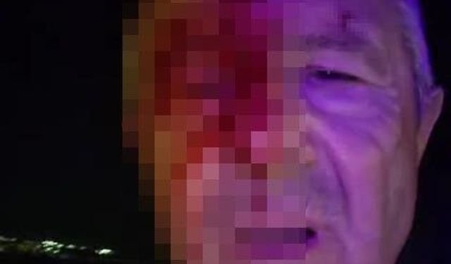 Haber yaparken saldırıya uğradı...Yüzü kanlar içinde kaldı