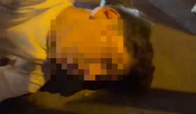 Bisikletli çocuk düşerek başını kaldırıma çarptı... Şoka girdi